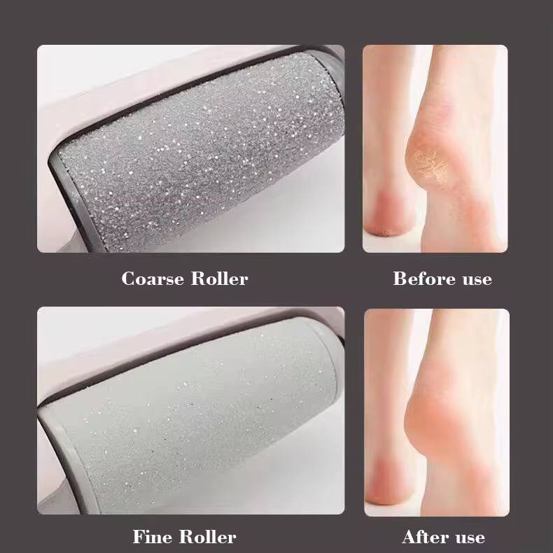 New electric cordless rechargeable callous remover