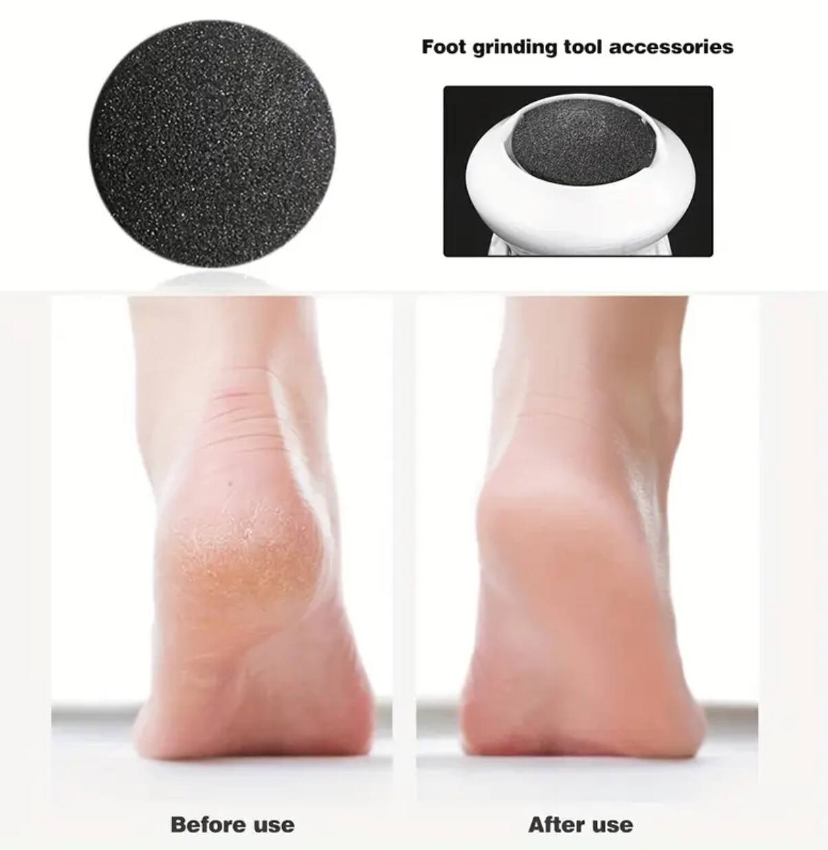 Rechargeable callus remover .